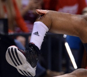 College basketball player Kevin Ware's leg was fractured by the Illuminati, Sunday.